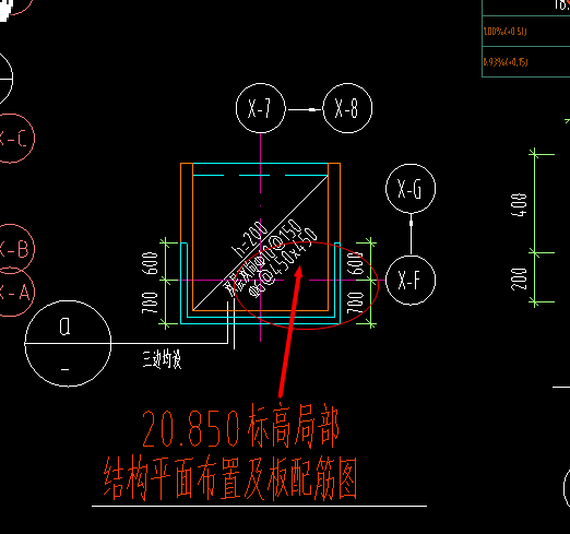括号