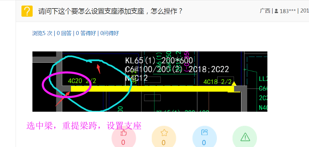支座