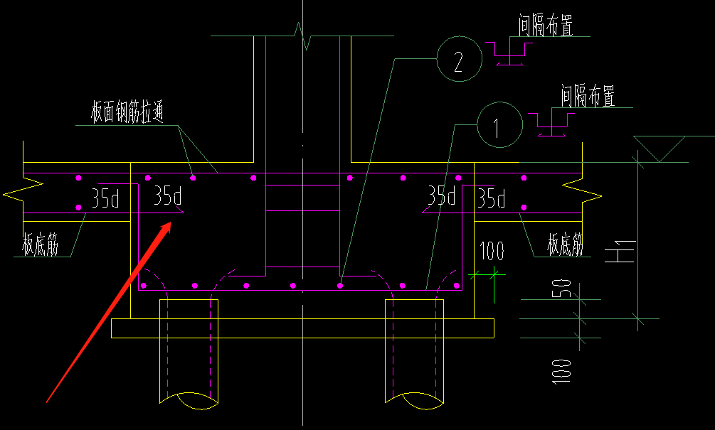 锚