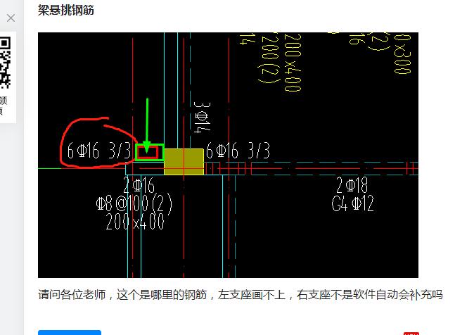 悬挑