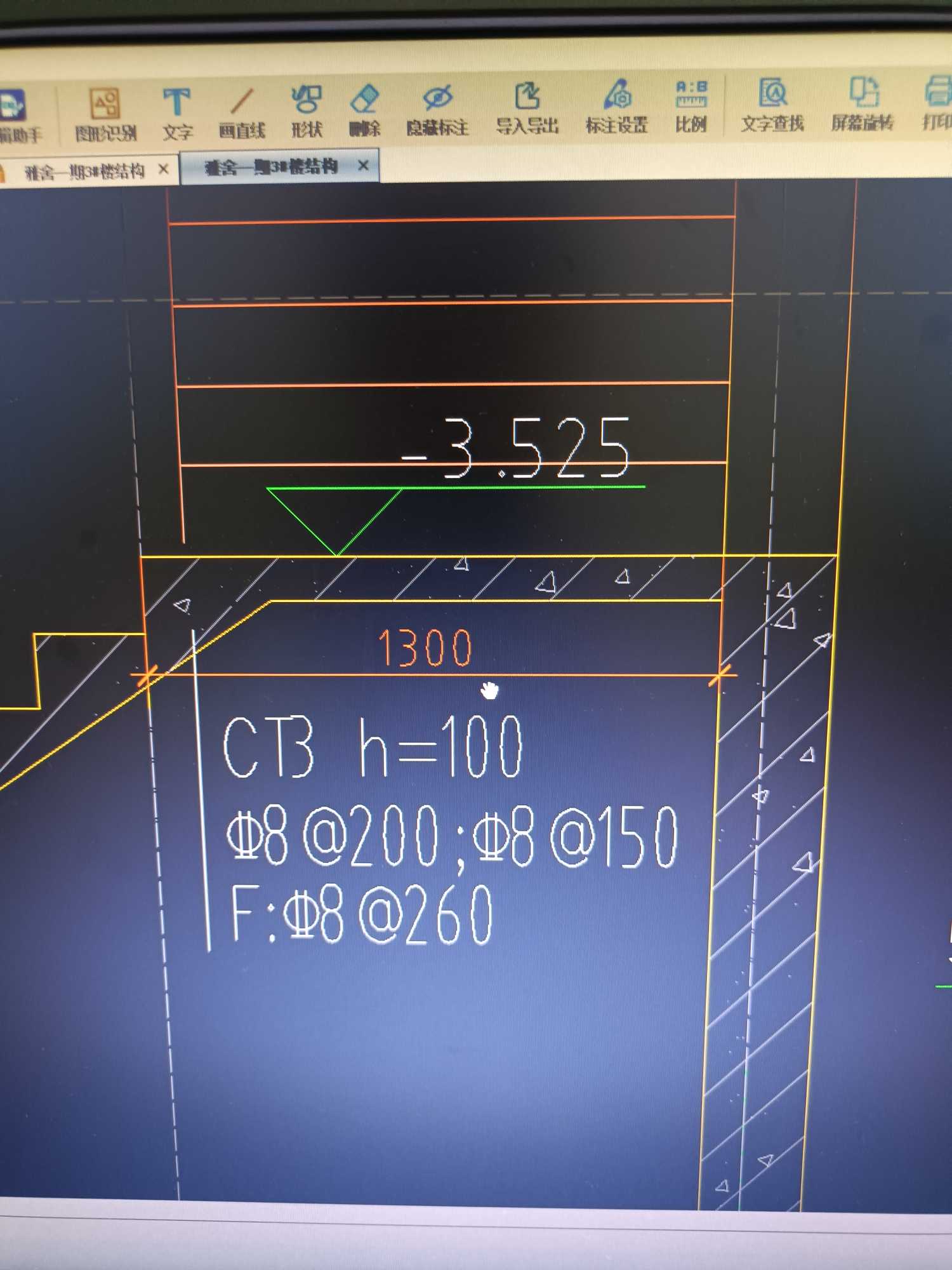 CT楼梯