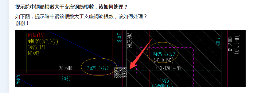 支座