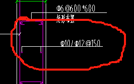 括号