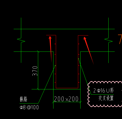 吊柱