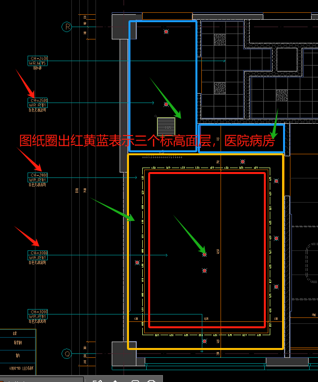投影面