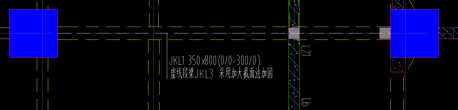 括号