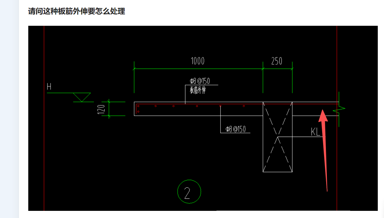 外伸